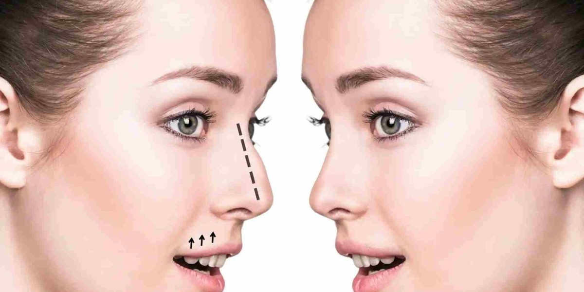 Nose Reduction Dubai: Understanding Nasal Proportion and Refinement
